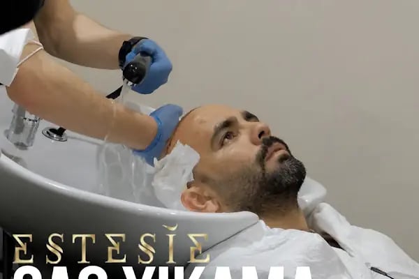 Estesie Clinic | İstanbul Medikal Estetik Merkezi Saç Ekimi Plastik Cerrahi Burun Dolgusu En iyi Naturel Botoks Klinik - Resim 9