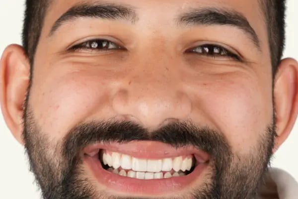 Luna Dente Diş Polikliniği - Resim 14