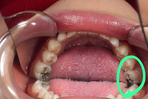 Luna Dente Diş Polikliniği - Resim 8