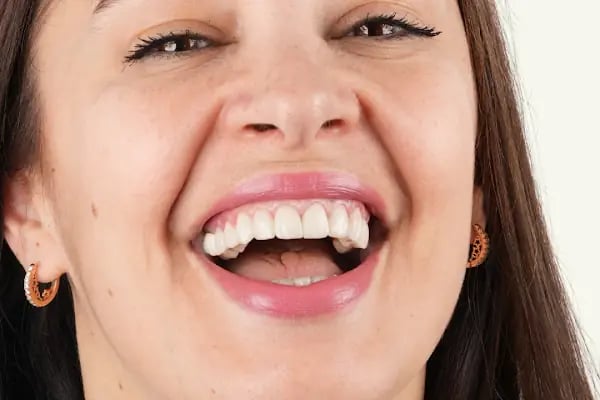 Luna Dente Diş Polikliniği - Resim 18