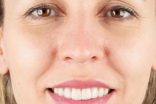 Luna Dente Diş Polikliniği - Resim 13
