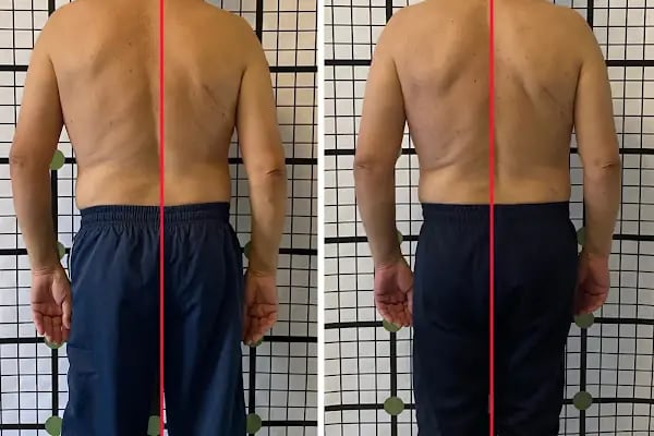 Çevik Fizyoterapi Sağlıklı Yaşam Merkezi - Resim 11