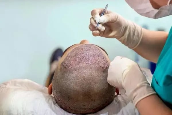 Esteticyana Clinic - Resim 8