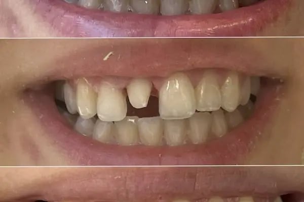 Diş Hekimi Ezgi Çimen - Alanya Dental House - Resim 5