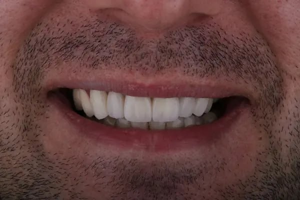 Dt.Şakir Doğualp Beşevler Diş Hekimi - Resim 10