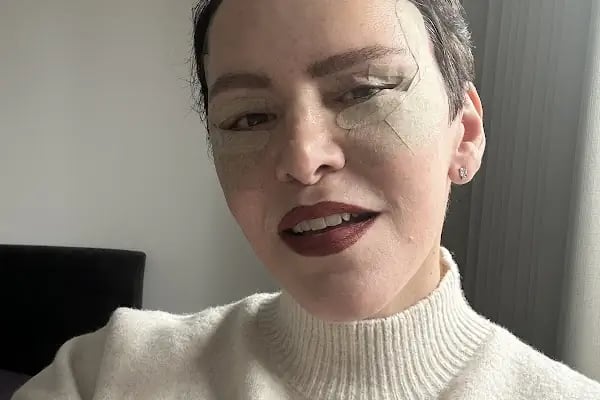 Dr. Ali Rıza Öreroğlu | Estetik Rekonstrüktif ve Plastik Cerrahi - Resim 13