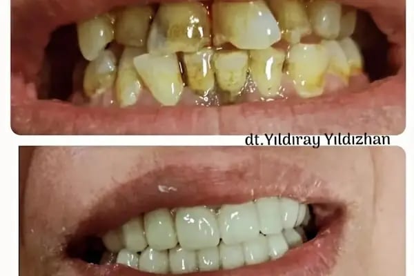 Hadımköy Diş Kliniği - Resim 7
