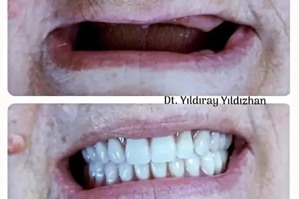 Hadımköy Diş Kliniği - Resim 8