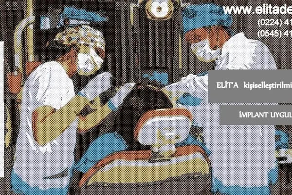 MSc.DDS. Diş Hekimi Koray DÖNMEZ - (Çene Cerrahisi ve İmplantoloji) - (Estetik Diş Hekimliği) - Resim 4
