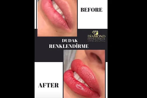 Diamond estetik güzellik - Resim 17