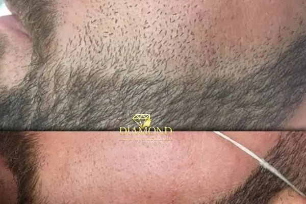 Diamond estetik güzellik - Resim 12