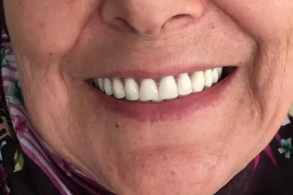 Diş Hekimi Hasibe Şahin - Resim 16