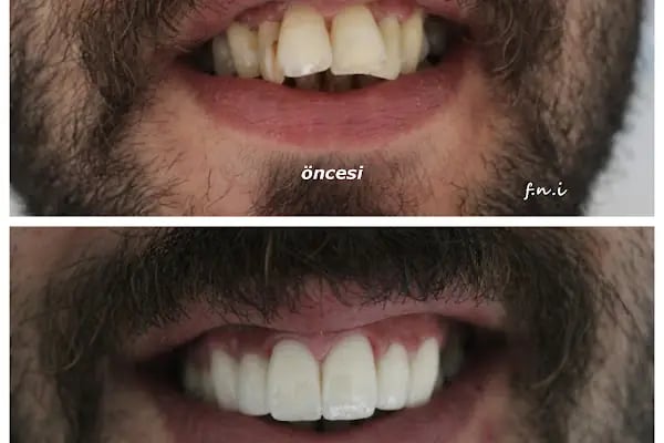 Diş Hekimi Ferit Naci İnce - Resim 3
