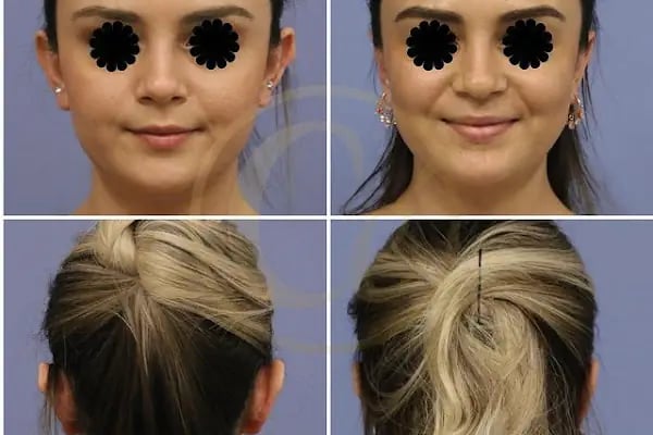 ESTHERIAN CLINIC SAĞLIK HİZMETLERİ SAN. TİC. LTD. ŞTİ. - Resim 20