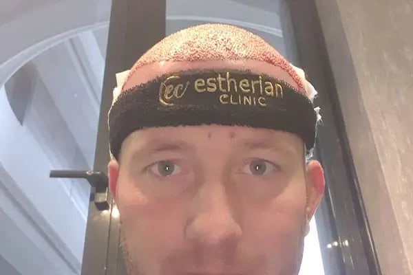 ESTHERIAN CLINIC SAĞLIK HİZMETLERİ SAN. TİC. LTD. ŞTİ. - Resim 14