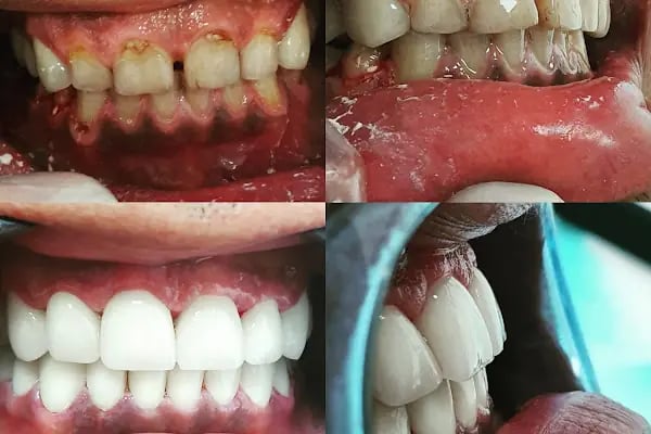 Nehir Ağız Ve Diş Sağlığı Polikliniği - Resim 11