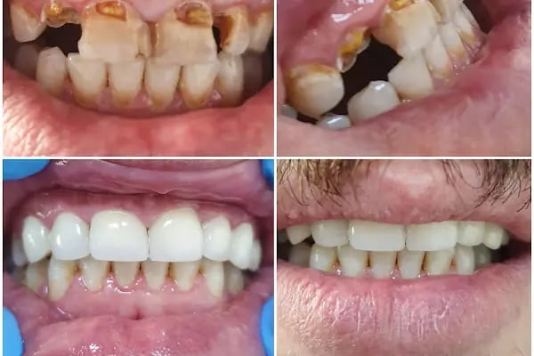 Nehir Ağız Ve Diş Sağlığı Polikliniği - Resim 13
