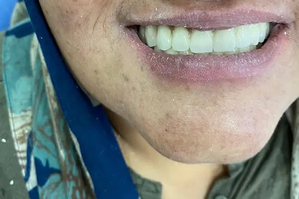 Diş Hekimi Özge Füsun MESUTOĞLU - Resim 8