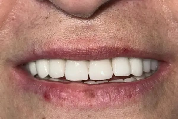 Özel Çayırova Ağız ve Diş Sağlığı Polikliniği - Resim 17
