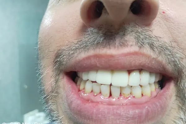 Özel Çayırova Ağız ve Diş Sağlığı Polikliniği - Resim 5