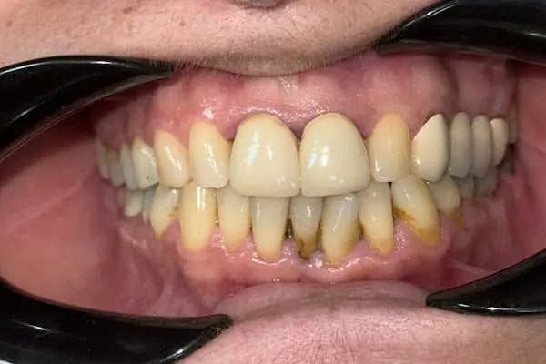 Özel Çayırova Ağız ve Diş Sağlığı Polikliniği - Resim 6