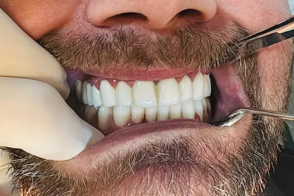Özel Çayırova Ağız ve Diş Sağlığı Polikliniği - Resim 14