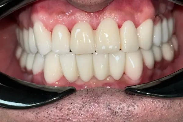 Özel Çayırova Ağız ve Diş Sağlığı Polikliniği - Resim 13