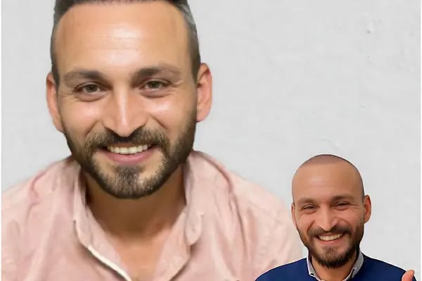Şura Ünal Saç Ekim Uzmanı - Resim 6