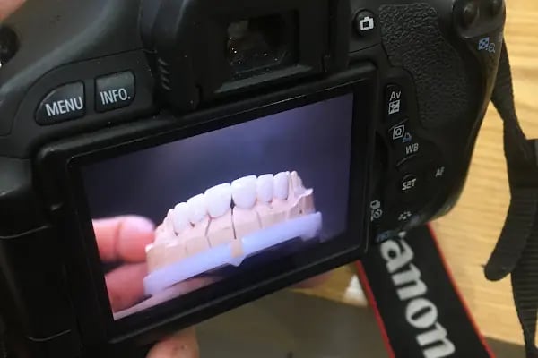 Konya Diş Hekimi Ahmet Dikici - Konya İmplant , Zirkonyum , Diş Estetik, Konya Diş Teli - Resim 17