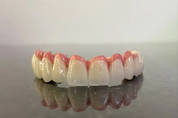 Konya Diş Hekimi Ahmet Dikici - Konya İmplant , Zirkonyum , Diş Estetik, Konya Diş Teli - Resim 5
