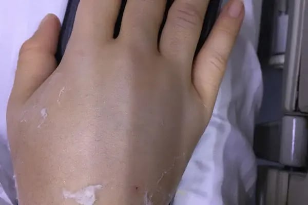 Doç. Dr. Semih Akkaya - Resim 1