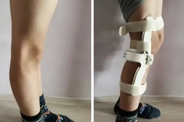 İnegöl Fizyoterapist Kardelen Özkaynak - Resim 2