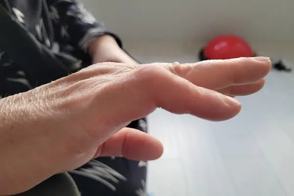 Fizyoterapist Ali Birinci Özel Sağlık Meslek Hizmet Birimi - Resim 9