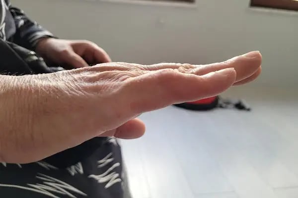 Fizyoterapist Ali Birinci Özel Sağlık Meslek Hizmet Birimi - Resim 8