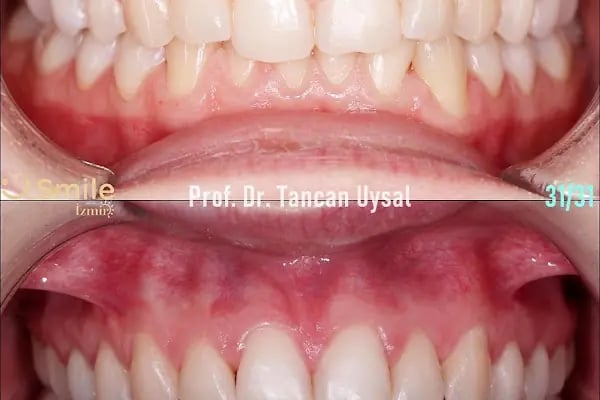 Smile İzmir - Resim 2