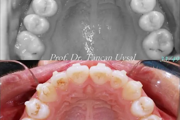 Smile İzmir - Resim 3