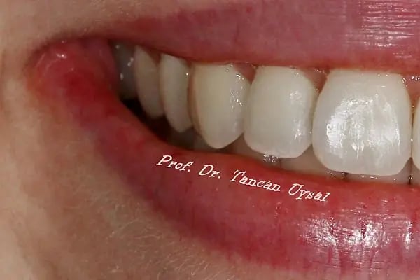 Smile İzmir - Resim 20