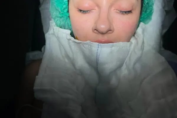 Op. Dr. Niyazi Altıntoprak | Burun Estetiği Doktoru - Resim 19