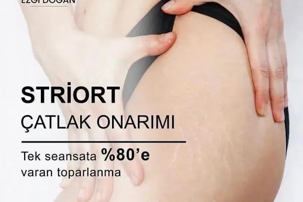 Aris Ezgi Doğan Malatya VIP Güzellik Merkezi - Resim 8
