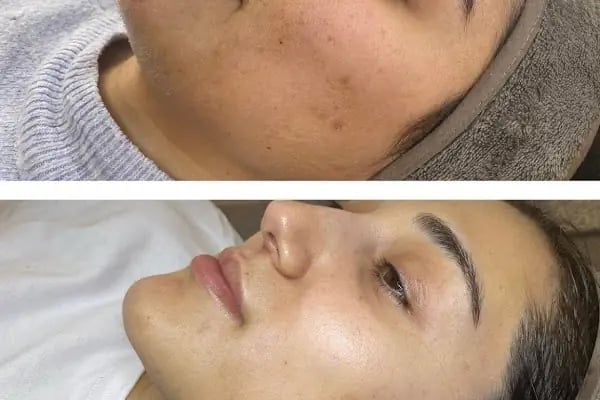 Aris Ezgi Doğan Malatya VIP Güzellik Merkezi - Resim 2