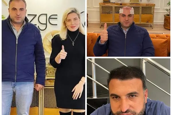 Özge Kara Saç Ekimi - Resim 12