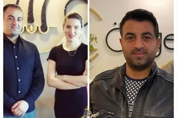 Özge Kara Saç Ekimi - Resim 17