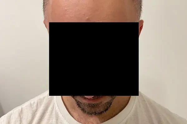 Op. Dr. İlhan Serdaroğlu - Resim 14