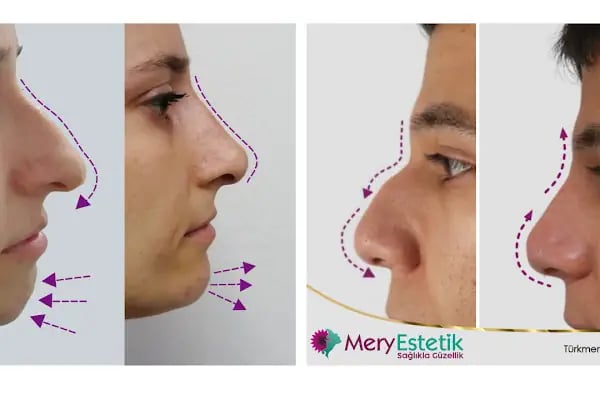 Mery Estetik - Resim 15