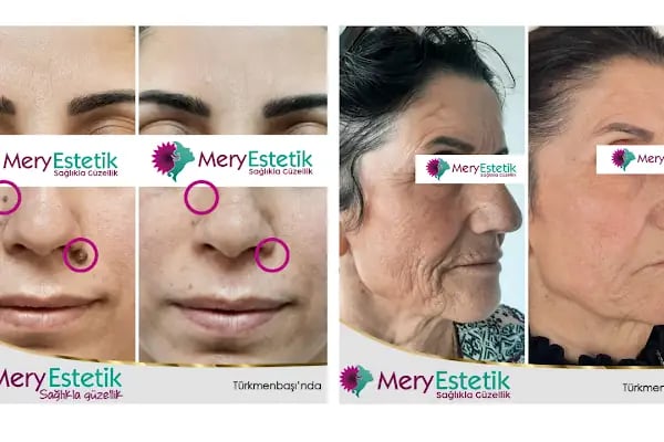 Mery Estetik - Resim 18