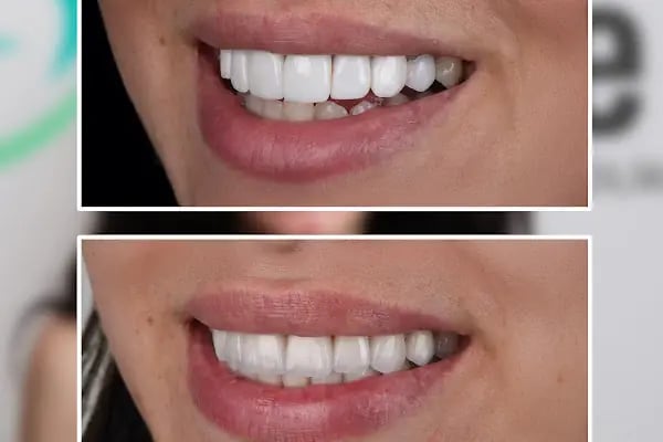 Eksen Ağız Ve Diş Sağlığı Polikliniği - Resim 12