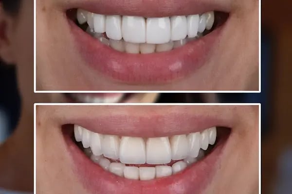 Eksen Ağız Ve Diş Sağlığı Polikliniği - Resim 11