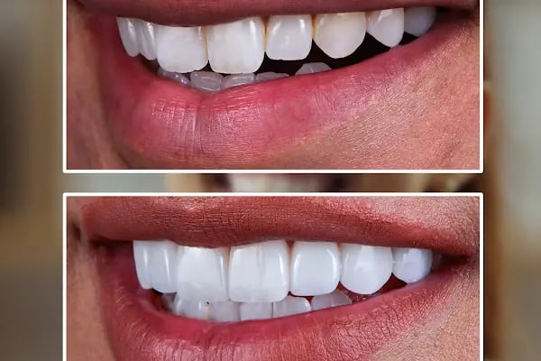 Eksen Ağız Ve Diş Sağlığı Polikliniği - Resim 8