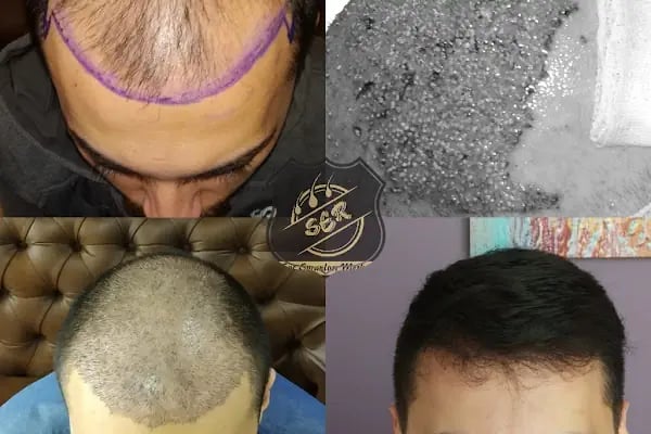 Ser Hair Center - Resim 15