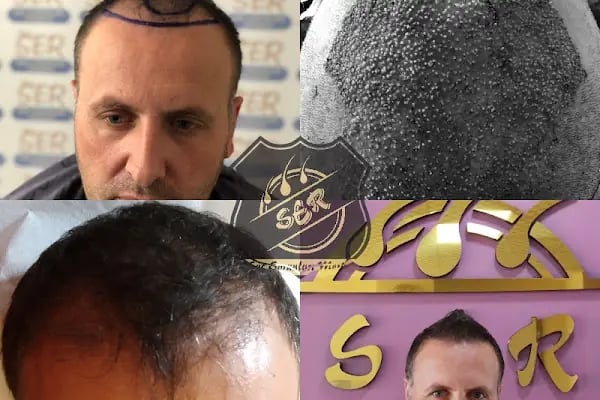 Ser Hair Center - Resim 16